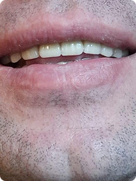 галерея изображения