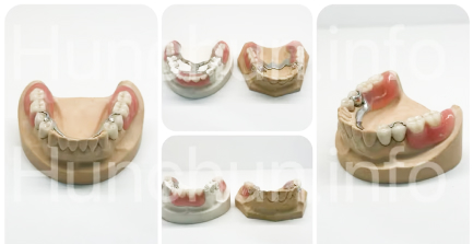 Полностью съемные зубные протезы