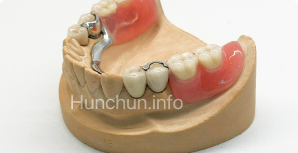 Протезы с бюгельным замком (скрытый замок)