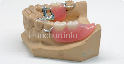 Протезы с кольцами, крючками фиксации